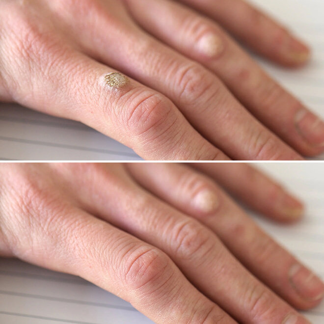 ClearaWella image